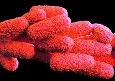 legionella come cosa