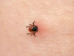 Malattia di lyme zecca zecche